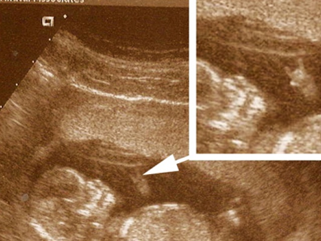 Future Longhorn Hooks 'Em - In the Womb