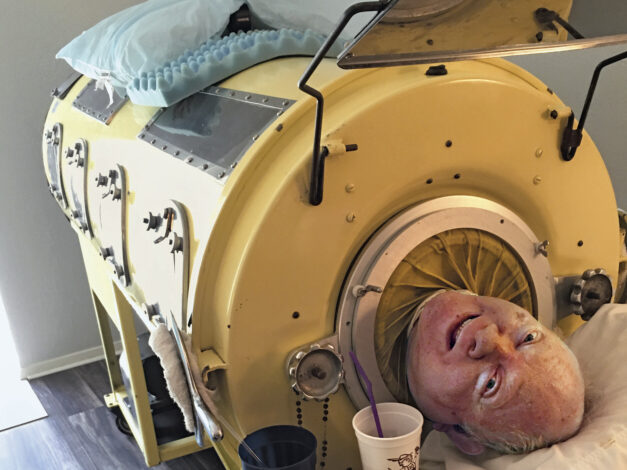 One Of The Last People To Live In An Iron Lung Is A Longhorn The Alcalde